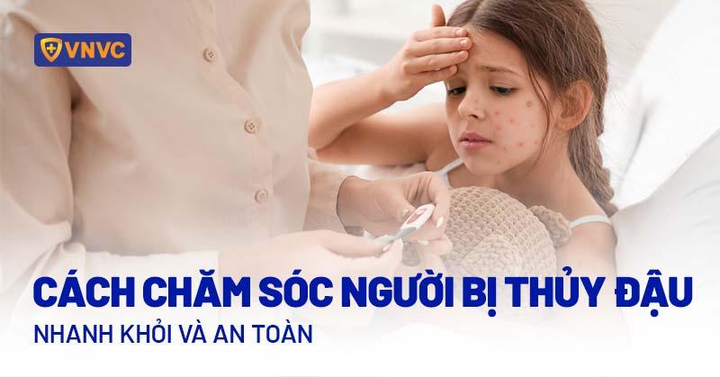 Cach cham soc nguoi benh thuy dau tai nha giup nhanh khoi